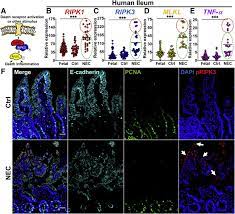 A Novel Role For Necroptosis In The Pathogenesis Of Necrotizing Enterocolitis Sciencedirect
