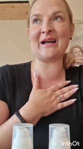 Ali po slovensko dishidroza, poznano? Veliko Slovencev ima dishidrozo, a le  malo kdo od njih, diagnosticirano. Kaj je dishidroza? Kako si lahko pomagam  z nego? Zakaj pride do dishidroze? ... #dyshidroticeczema #dishidroza #