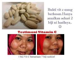 Vitamin shaklee berbeza dengan vitamin lain di farmasi sebab vitamin shaklee merupakan vitamin semulajadi. Kesan Amalkan Vitamin C Shaklee Hayatisuki