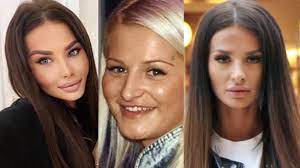 Instagramová královna zuzana „queen plačková, někdejší playmate a účastnice reality show hotel paradise, zveřejnila na svém profilu na sociální síti. Plackovej Sokujuca Plastika Takto Vyzerala Kedysi