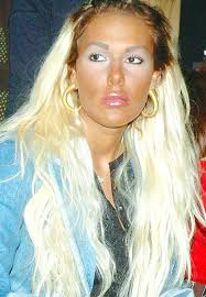 Sadece Dudaklarımda Estetik Var" Diyen Sosyetenin En Ünlü Kadını Hande  Acar'ın Geçmişten Günümüze Şoke Eden Evrimi