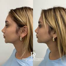 TOP 10 BEST Facial Plastic Surgeon in Miami, FL