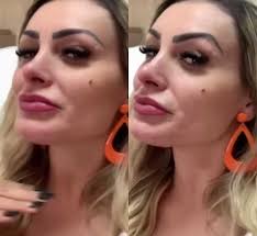 Andressa urach resolveu mandar um recado especial para tati miretato. Andressa Urach Faz Preenchimento No Nariz E No Queixo Veja Resultado