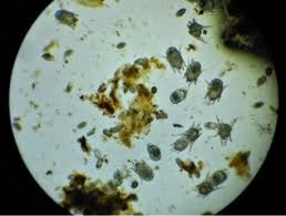 Image result for what do otodectes cynotis look like in dog fur