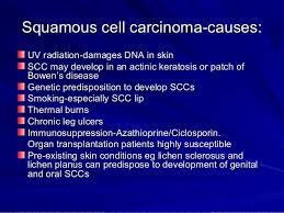 What is a squamous cell carcinoma? Skin Cancer
