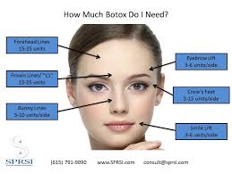 How much is a brow lift botox. Determine How Much Botox You Will Need Sprsi Blog