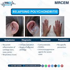 Image result for Relapsing Polychondritis