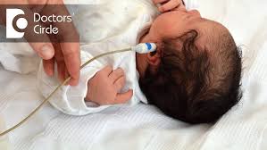 Image result for Pediatric Auditory Screening