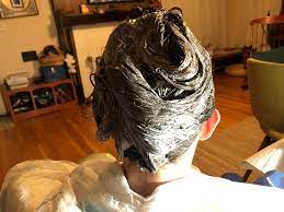 San Diego California Head Lice Treatment Mobile In Home Removal Service Licedoctors