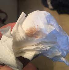 This is when the hormones that control your menstrual cycle triggers bleeding. Tmi Anybody Have Discharge Spotting That Looks Like This During Pregnancy I M Stressing Out And I M Terrified Can T Get Into A Doctor Until I Am 8 Weeks Are The Crazy Rules Here And