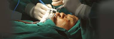 Image result for Sinus Surgery