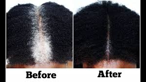 This can help you get healthy black hair from the roots. Classicsalespage