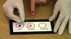 Precizarea grupului sanguin a unei persoane trebuie să conțină obligatoriu tipul de antigen oab și prezența sau absența facorului rh. Grupele De Sange Youtube