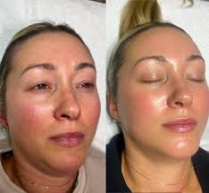 Nouveau Permanent Cosmetics & Skin repair in Ridgeland Ms.