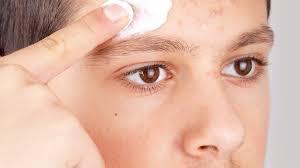 Image result for yellow scabs on the face in children