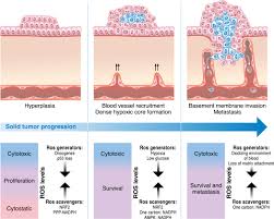 Cancer indicates a disease characterized by the abnormal and unregulated growth of cells. Fundamentals Of Cancer Metabolism Science Advances