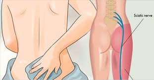 Pin On Nutrition And Wellness
