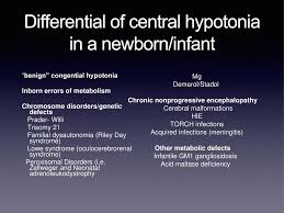 They can't fully experience taste. Hypotonia The Floppy Infant Ppt Download