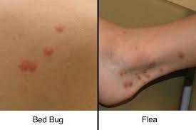 Image result for flea bites