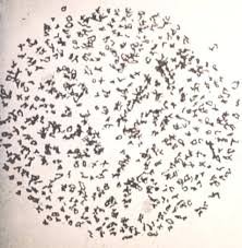 Image result for Ophioglossum reticulatum