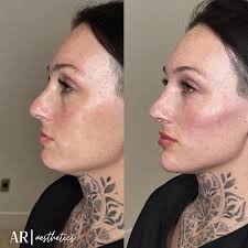 AR Aesthetics St. Petersburg: See Client Testimonials