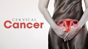 Most cases happen in the lining of the uterus these can play a role in how likely you are to have uterine cancer. What Are The Early Signs Symptoms Of Cervical Cancer Apollo Hospitals Blog