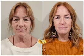 Update*** Sheileen C