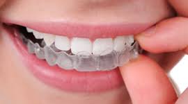 Glues also tend to weaken the denture and make daily cleaning difficult. My Upper Denture Is Ok But My Lower Denture Is Loose And Sore And I Have Never Been Able To Get On With It What Can I Do Dental Blog