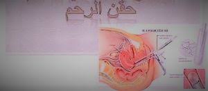وقد يستخدم التلقيح الاصطناعي في تركيا تقنيات الإنجاب المساعدة وتقنيات التبرع بالحيوانات. Ù†ÙŠÙˆØ²ÙŠÙ„Ø§Ù†Ø¯Ø§ Ø§Ø¹ØªØ²Ù… Ø§Ù„Ù‚ØµØ© Ø§Ù„Ù…Ø«ÙŠØ±Ø© Ù‡Ù„ ÙŠÙ†Ø¬Ø­ Ø§Ù„ØªÙ„Ù‚ÙŠØ­ Ø§Ù„Ù…Ù†Ø²Ù„ÙŠ Hotelmarbore Com