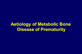 Metabolic Bone Disease Bone Study Day 28th September Ppt Video Online Download