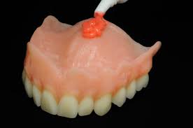 denture adhesive from your mouth