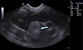 It's called an aortic thromboembolism (ate), or saddle thrombus, and usually occurs in cats with heart disease — something else the owner may not know their cat has. Feline Aortic Thromboembolism Fate Mar Vista Animal Medical Center