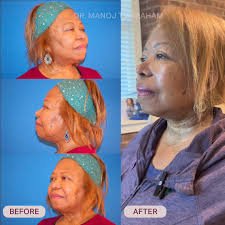 Kris Jenner's new look has the internet buzzing—and for good reason. 👀 Dr.  Abraham weighs in