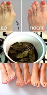 норма мочевой кислоты в крови у женщин после 60 лет Poka Neyasno Pochemu Vrachi Derzhat Eto V Sekrete Vot Kak Izbavitsya Ot Kostochki Na Stupne S Pomoshyu Sovershenno Estestvennogo Herbal Cure Organic Health Herbalism