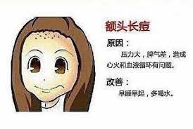 长痘痘的原因及改善方法 skin treatments beauty face treatment