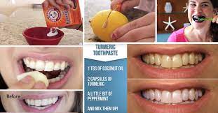 But even natural teeth whitening methods can cause damage to the teeth, eroding the enamel and potentially causing more damage—and ask the dentist is supported by readers. 15 Super Easy Homemade Teeth Whitening Remedies To Get Those Pearly Whites Back