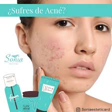 Sonia Estetica & Spa (@soniaesteticard) • Instagram photos and videos