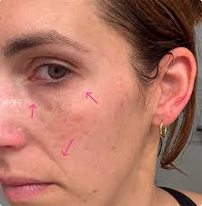 Even Her Dermatologist Couldn't Believe She Was 67