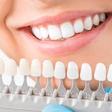 Porcelain veneers straighten your smile not by moving your teeth but reshaping them. Porcelain Veneers Are A Great Solution For A Smile Makeover