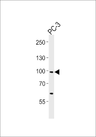 Anisakis, igg антитела к возбудителю анизакидоза (нематодам рода anisakis), igg. Scap Antibody Mybiosource