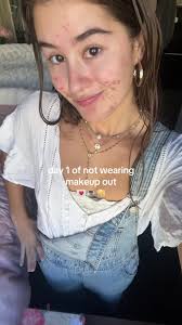 Lilli Kay Before and After