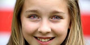 Contact lenses are great at improving vision but can also make your eyes uncomfortable and puts them at risk of infection, so knowing how to wear contact lenses is very important. Children And Contact Lenses Colorlens4less Net