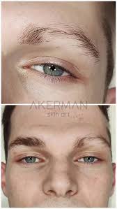 Carolina Akerman SKIN ART (@akermanskinart) · Torremolinos-Málaga