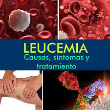 Maybe you would like to learn more about one of these? Leucemia Causas Sintomas Y Tratamiento La Guia De Las Vitaminas