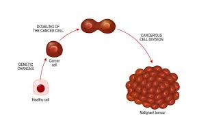 Epidemiology approximately 90% of cases occur in patients under 15 years of age, most commonly between 6. Soft Tissue Sarcoma What You Need To Know About This Rare Cancer Medanta