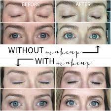 Rodan + fields knew that an ingredient in lash boost was associated with adverse side effects and failed to disclose them to consumers. Rodan And Fields Lash Boost Review The Chronicles Of Home