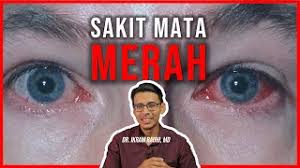 Cendo xitrol adalah salah satu obat tetes mata antibiotik yang biasanya harus dibeli indikasi obat tetes mata ini adalah untuk membantu mengatasi iritasi hingga infeksi pada mata yang menyebabkan mata merah, berair, hingga terdapat. Punca Dan Rawatan Sakit Mata Merah Acute Conjunctivitis Tips Dan Cara Pakai Ubat Titis Mata Youtube