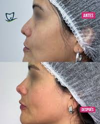 Alto Valle Odontología