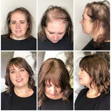 Causes like pollution, stress 3, overuse of chemical hair products, hormonal imbalance can make your hair lifeless and flat, or lead to hair loss and thinning. Corso Infoltimento Ad En Human Hair Wigs Fair Fashion Natural Line