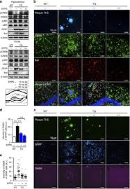 Detail 22 februari 2016 prosedur pembelian tes berikut prosedur pembelian tes psikologi di tempat kami: Epps Rescues Hippocampus Dependent Cognitive Deficits In App Ps1 Mice By Disaggregation Of Amyloid B Oligomers And Plaques Abstract Europe Pmc